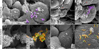 Immunometabolic Analysis of Mobiluncus mulieris and Eggerthella sp. Reveals Novel Insights Into Their Pathogenic Contributions to the Hallmarks of Bacterial Vaginosis